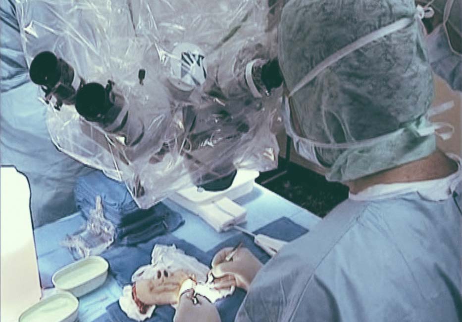 Équipe chirurgicale durant une transplantation faciale