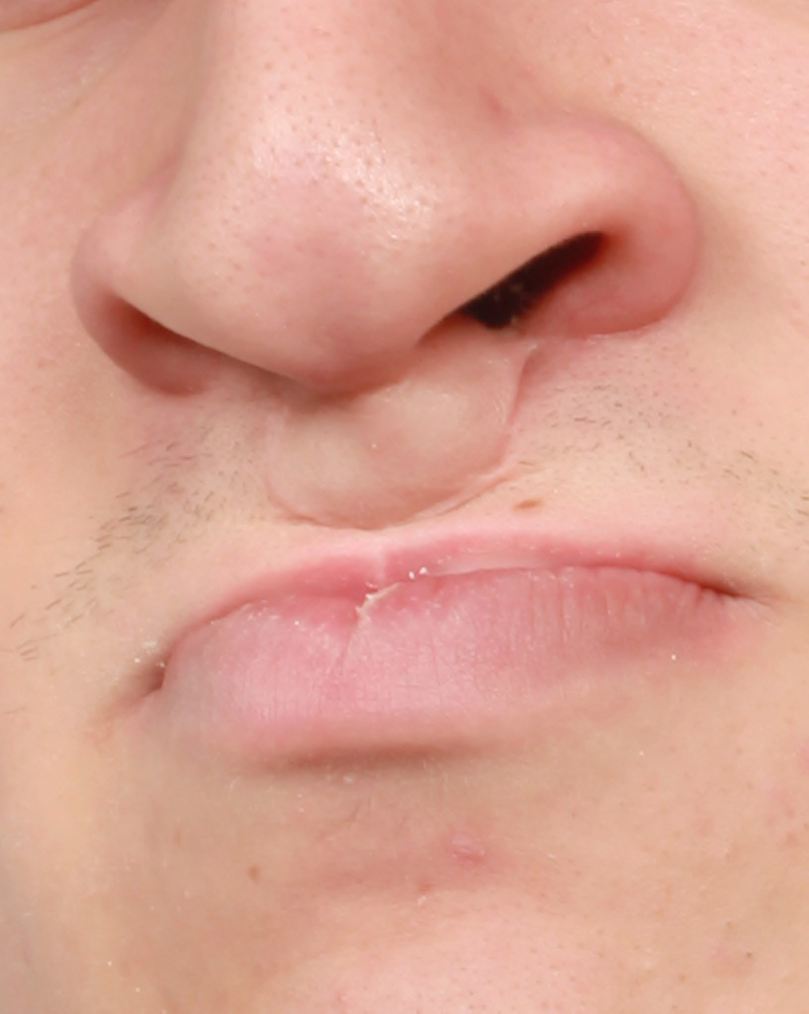 Détail d’un nez et d’une bouche