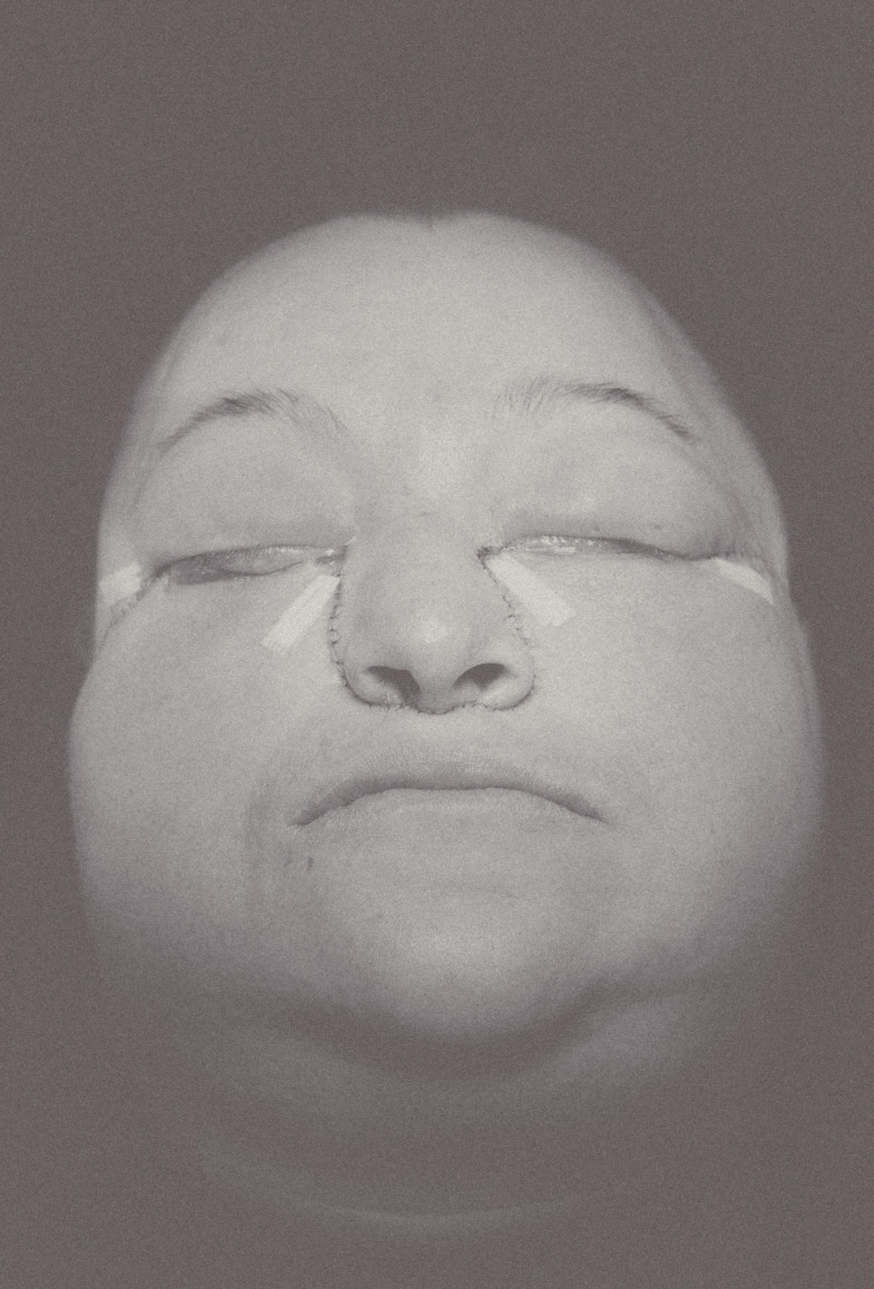 Portrait clinique en fin d’intervention